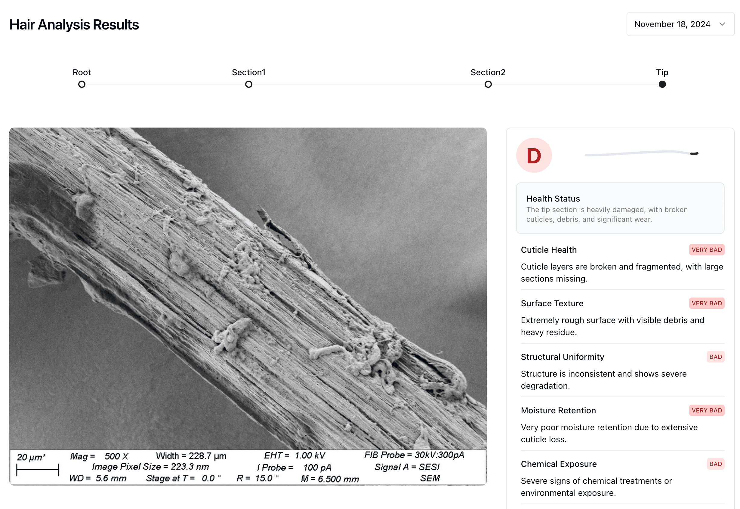 Hair tip analysis under electron microscope